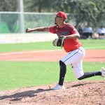 ¿Se quemó Yuridia? Revela extraña marca en su rostro | VIDEO